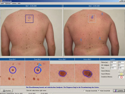 Bodyscan pro
