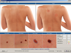 body scan pro